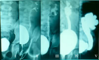 Urologia Figura 1